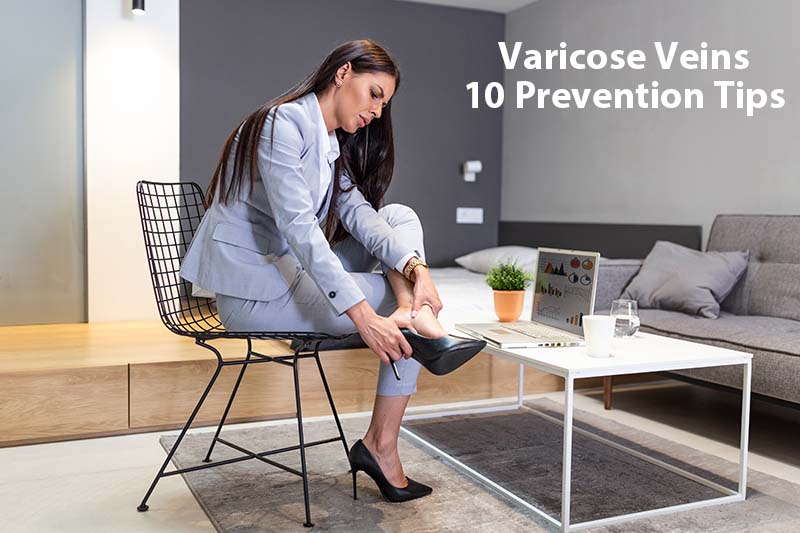 10 Tips for Prevention of Varicose Veins